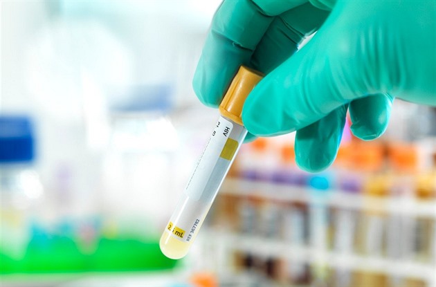 Evropská komise schválila injekci na prevenci HIV, podílel se na ní český virolog