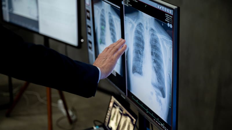 K lékaři šla Češka se zlomeným žebrem. AI však našla miniaturní nádor a zachránila ženě život