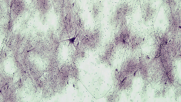 Firma staví datacentra z lidských mozkových buněk. Teoreticky jsou výhodná