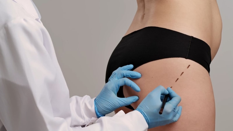 Tlak na vzhled ji stál život: Britka zemřela po sérii plastických operací, bylo jí 28 let